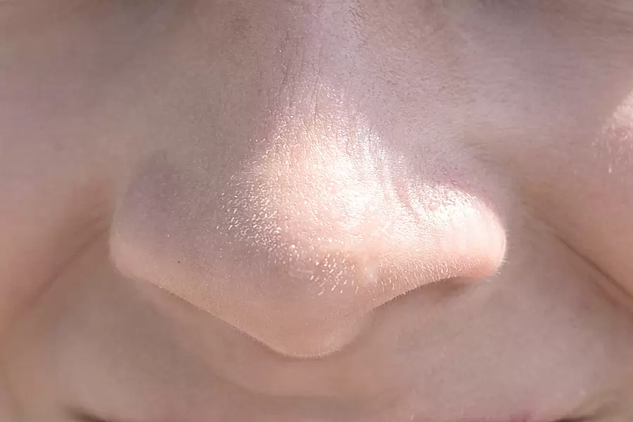 洗顔しても出てくる鼻周りの白い物体は何 毛穴の汚れなの あしたの美肌 専門家による美容コラム